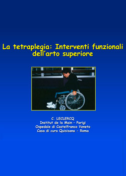 tetraplegia_arti_superiori