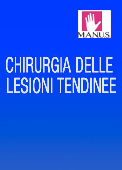 chirurgia_lesioni_tendinee